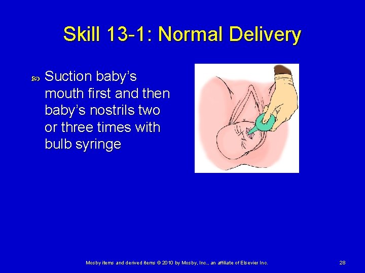 Skill 13 -1: Normal Delivery Suction baby’s mouth first and then baby’s nostrils two Skill 13 -1: Normal Delivery Suction baby’s mouth first and then baby’s nostrils two