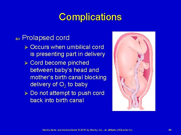 Complications Prolapsed cord Occurs when umbilical cord is presenting part in delivery Ø Cord Complications Prolapsed cord Occurs when umbilical cord is presenting part in delivery Ø Cord