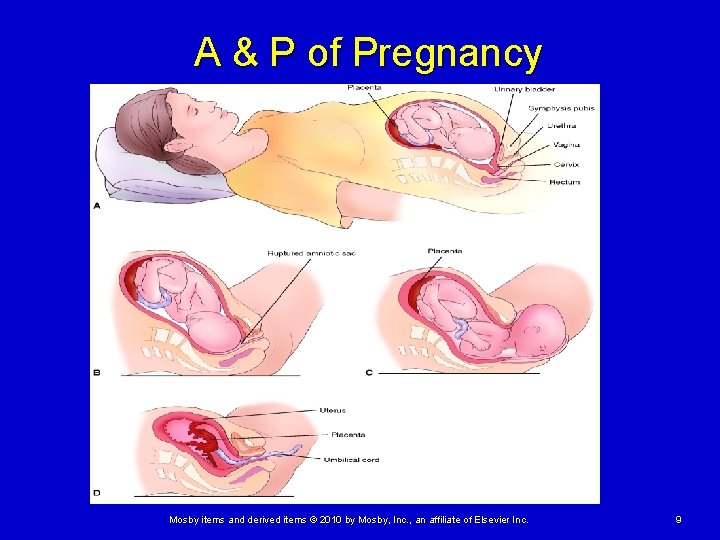 A & P of Pregnancy Mosby items and derived items © 2010 by Mosby, A & P of Pregnancy Mosby items and derived items © 2010 by Mosby,