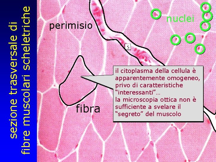 sezione trasversale di fibre muscolari scheletriche perimisio fibra nuclei il citoplasma della cellula è