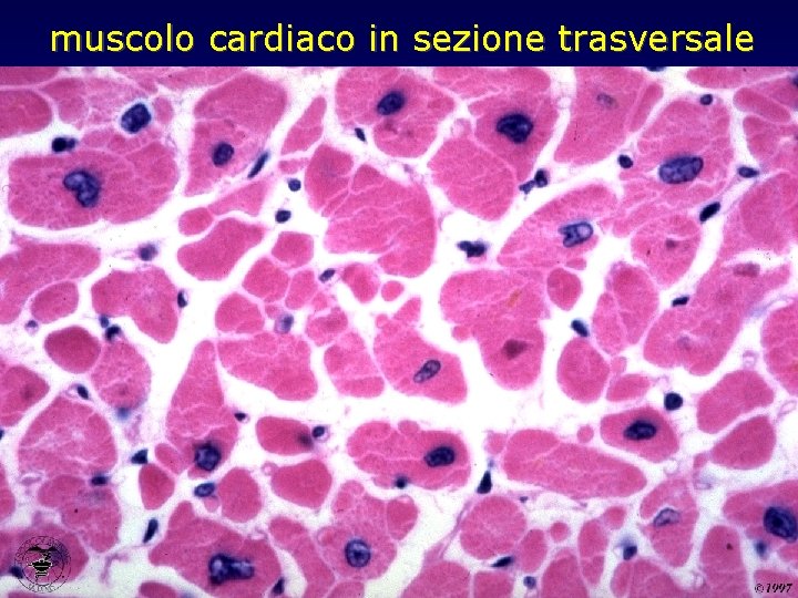 muscolo cardiaco in sezione trasversale 