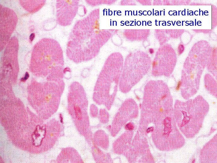 fibre muscolari cardiache in sezione trasversale 