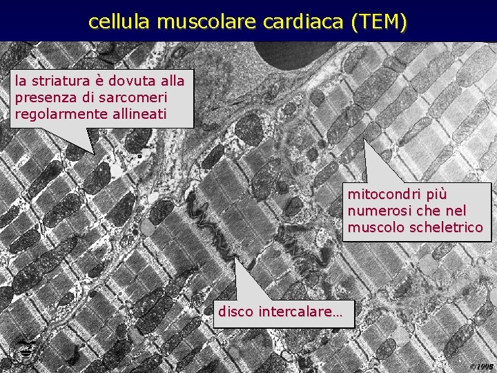 cellula muscolare cardiaca (TEM) la striatura è dovuta alla presenza di sarcomeri regolarmente allineati