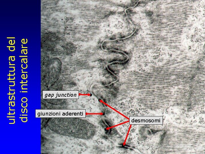 ultrastruttura del disco intercalare gap junction giunzioni aderenti desmosomi 