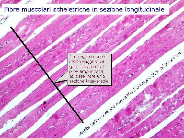Fibre muscolari scheletriche in sezione longitudinale ) l’immagine non è molto suggestiva (per il