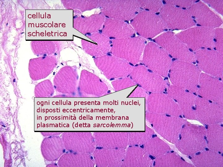 muscolo scheletrico in sezione cellula trasversale muscolare scheletrica ogni cellula presenta molti nuclei, disposti