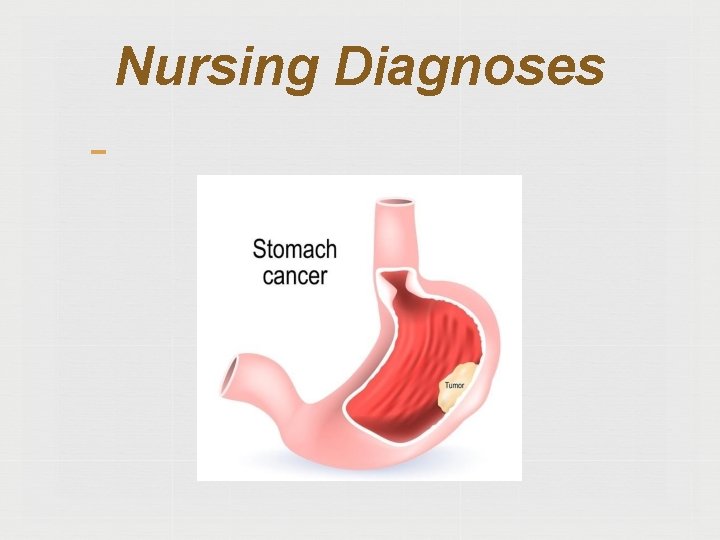 Nursing Diagnoses 