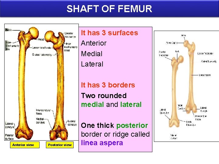 SHAFT OF FEMUR It has 3 surfaces Anterior Medial Lateral It has 3 borders