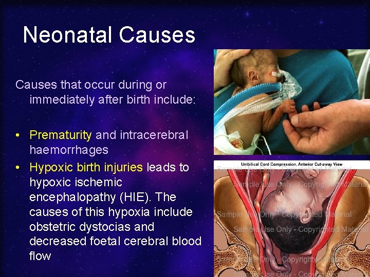 Neonatal Causes that occur during or immediately after birth include: • Prematurity and intracerebral