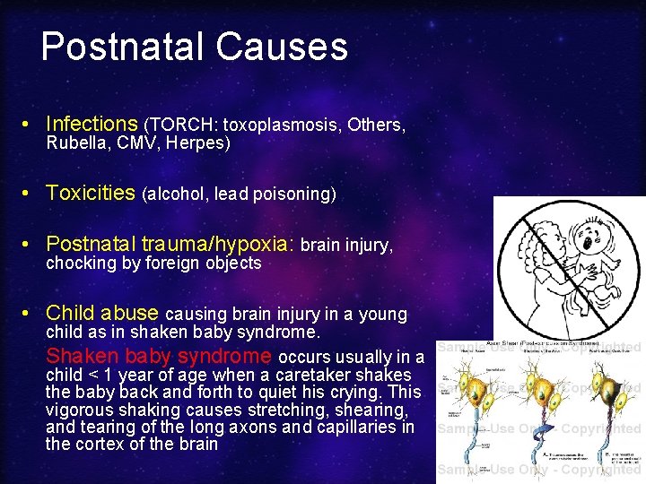 Postnatal Causes • Infections (TORCH: toxoplasmosis, Others, Rubella, CMV, Herpes) • Toxicities (alcohol, lead