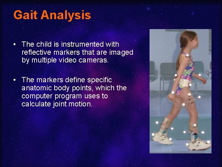Gait Analysis • The child is instrumented with reflective markers that are imaged by