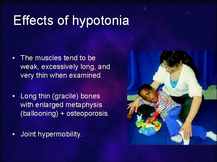 Effects of hypotonia • The muscles tend to be weak, excessively long, and very