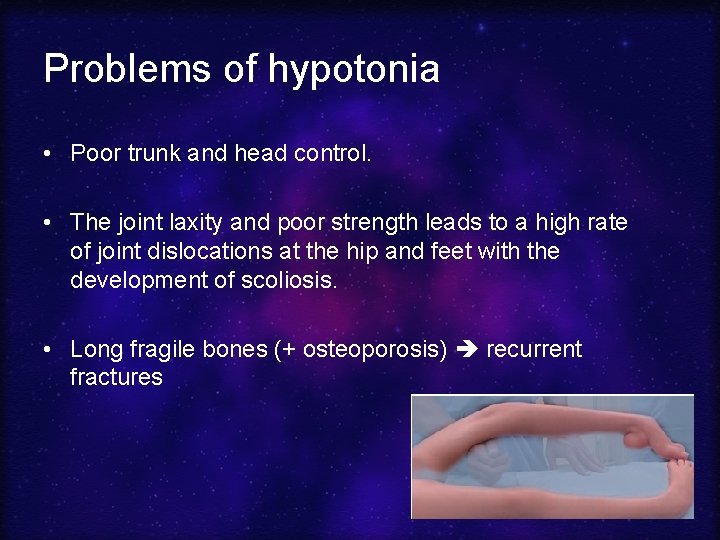 Problems of hypotonia • Poor trunk and head control. • The joint laxity and