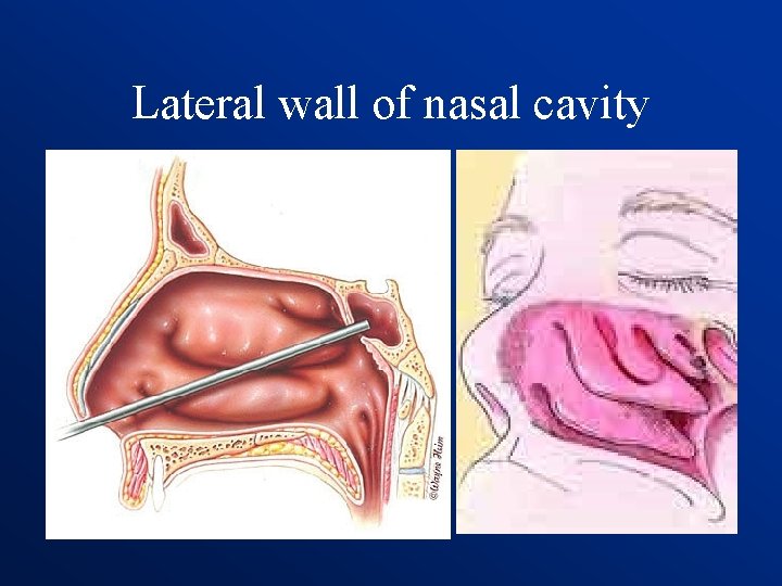 Lateral wall of nasal cavity 