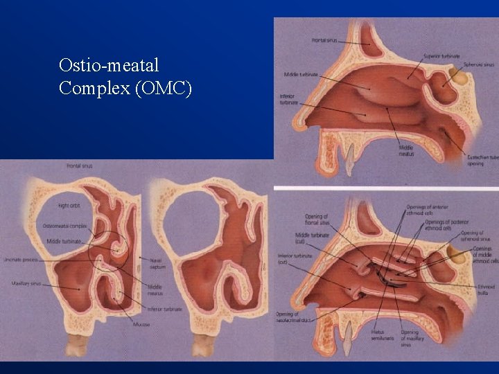 Ostio-meatal Complex (OMC) 