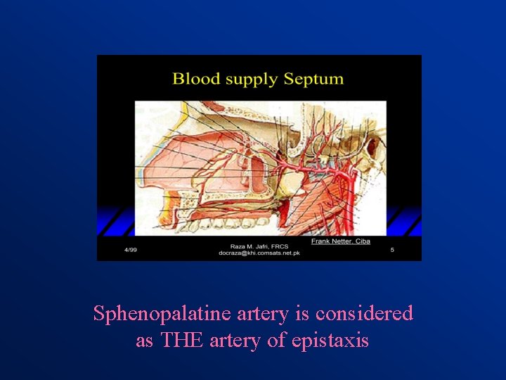 Sphenopalatine artery is considered as THE artery of epistaxis 