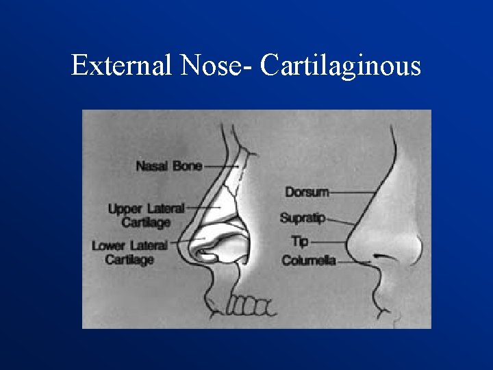 External Nose- Cartilaginous 