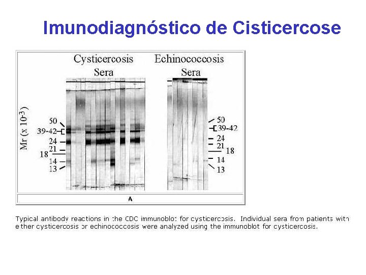 Imunodiagnóstico de Cisticercose 