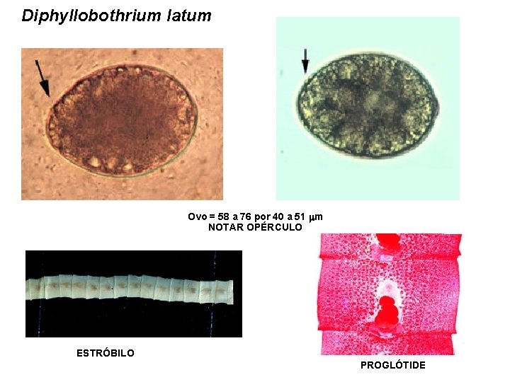 Diphyllobothrium latum Ovo = 58 a 76 por 40 a 51 mm NOTAR OPÉRCULO