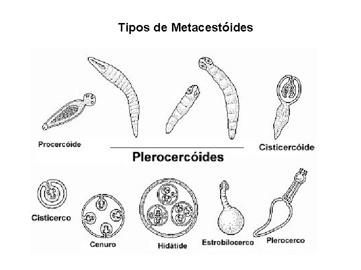 Tipos de Metacestóides 