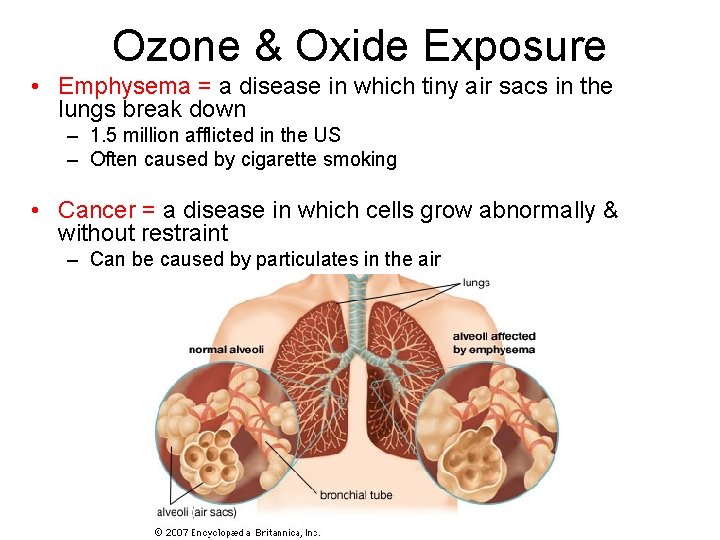 Ozone & Oxide Exposure • Emphysema = a disease in which tiny air sacs