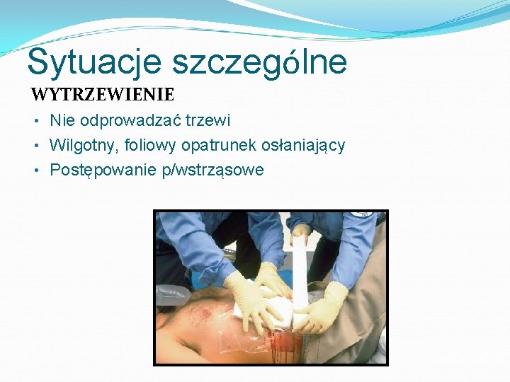 Sytuacje szczególne WYTRZEWIENIE • Nie odprowadzać trzewi • Wilgotny, foliowy opatrunek osłaniający • Postępowanie