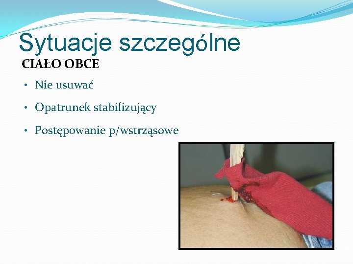 Sytuacje szczególne CIAŁO OBCE • Nie usuwać • Opatrunek stabilizujący • Postępowanie p/wstrząsowe Abdominal