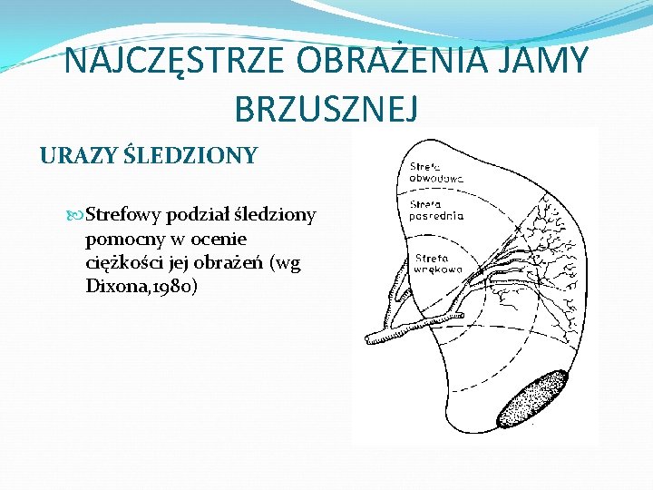 NAJCZĘSTRZE OBRAŻENIA JAMY BRZUSZNEJ URAZY ŚLEDZIONY Strefowy podział śledziony pomocny w ocenie ciężkości jej