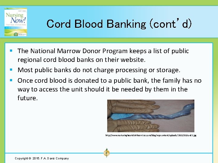 Cord Blood Banking (cont’d) § The National Marrow Donor Program keeps a list of
