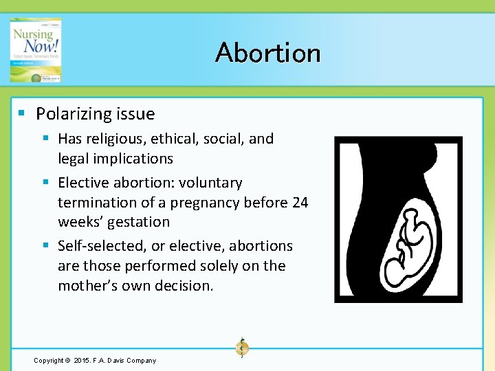 Abortion § Polarizing issue § Has religious, ethical, social, and legal implications § Elective