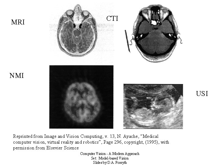 MRI CTI NMI USI Reprinted from Image and Vision Computing, v. 13, N. Ayache,