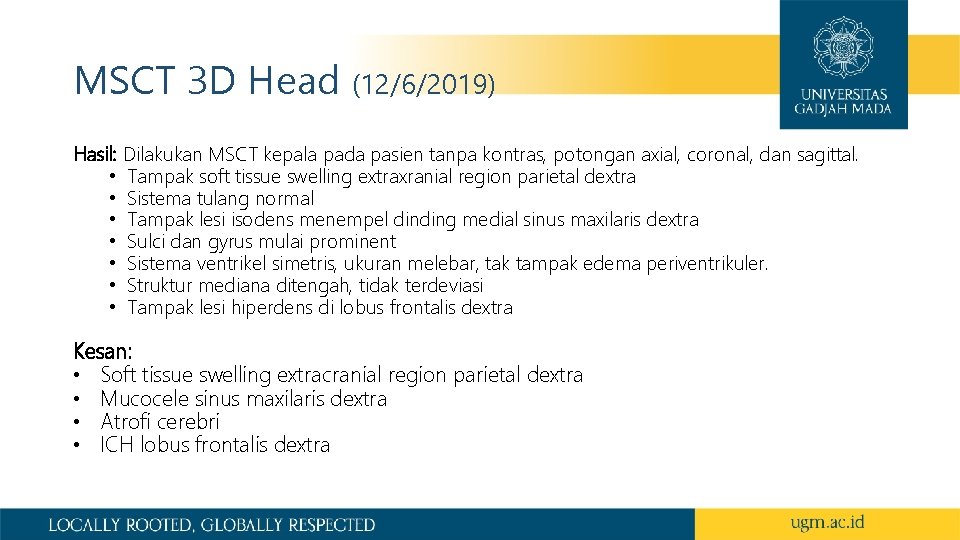 MSCT 3 D Head (12/6/2019) Hasil: Dilakukan MSCT kepala pada pasien tanpa kontras, potongan
