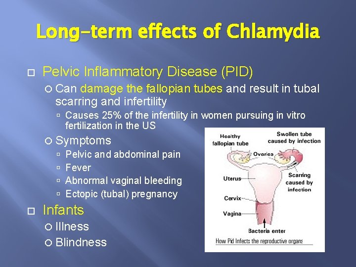 Long-term effects of Chlamydia Pelvic Inflammatory Disease (PID) Can damage the fallopian tubes and