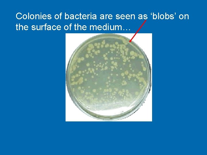 Colonies of bacteria are seen as ‘blobs’ on the surface of the medium… 