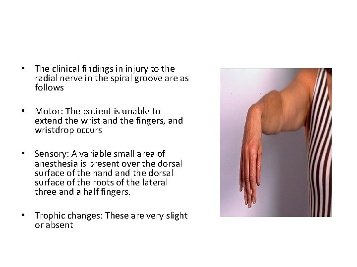  • The clinical findings in injury to the radial nerve in the spiral