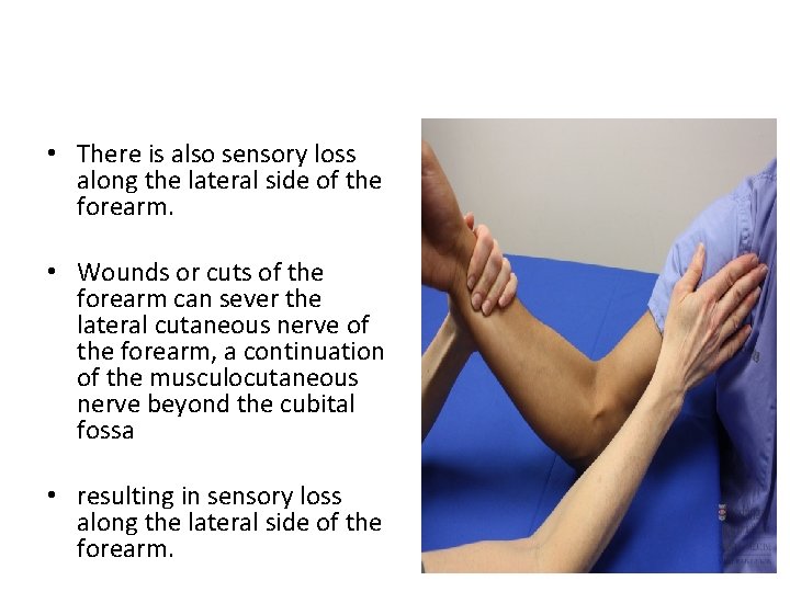  • There is also sensory loss along the lateral side of the forearm.