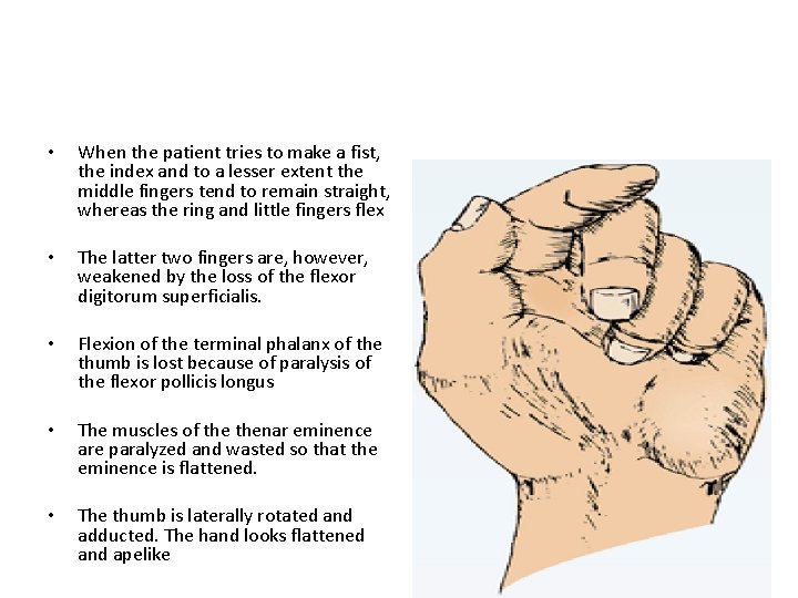  • When the patient tries to make a fist, the index and to