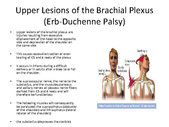 Upper Lesions of the Brachial Plexus (Erb-Duchenne Palsy) • Upper lesions of the brachial