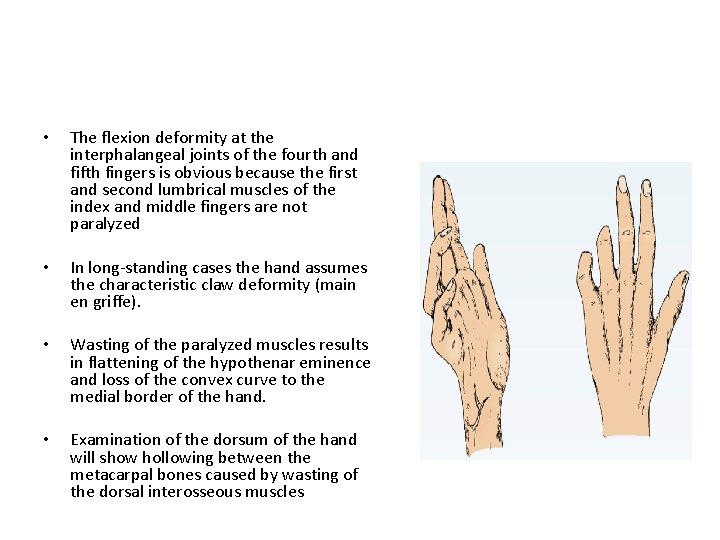  • The flexion deformity at the interphalangeal joints of the fourth and fifth