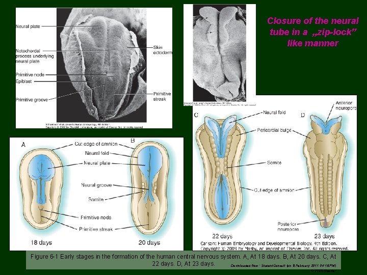 Closure of the neural tube in a „zip-lock” like manner Figure 6 -1 Early