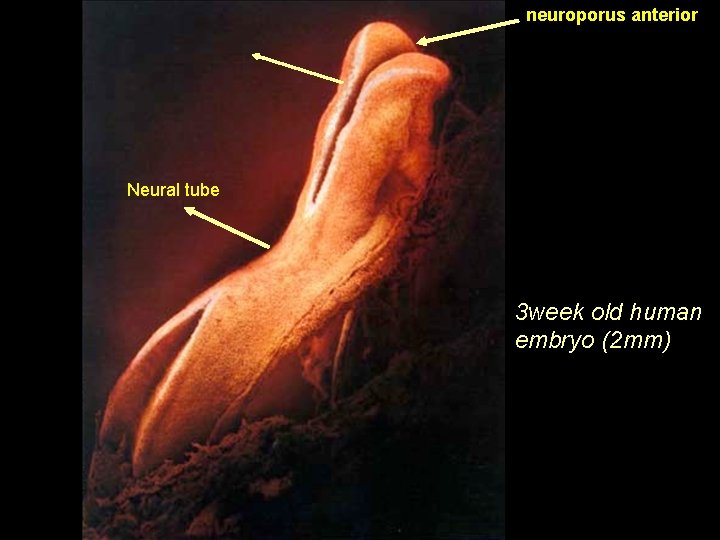 neuroporus anterior Neural tube 3 week old human embryo (2 mm) 