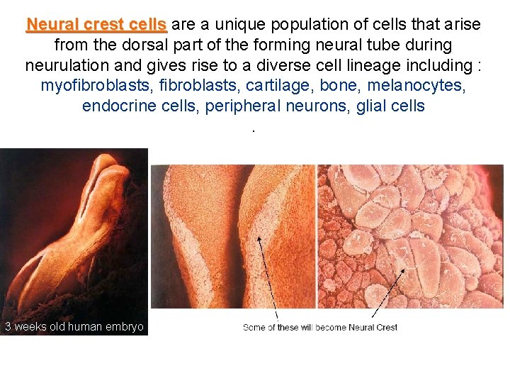 Neural crest cells are a unique population of cells that arise from the dorsal