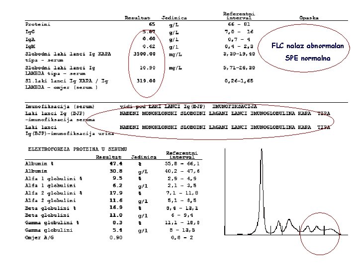 FLC nalaz abnormalan SPE normalna 