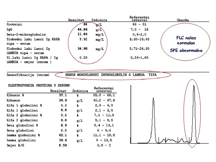 FLC nalaz normalan SPE abnormalna 