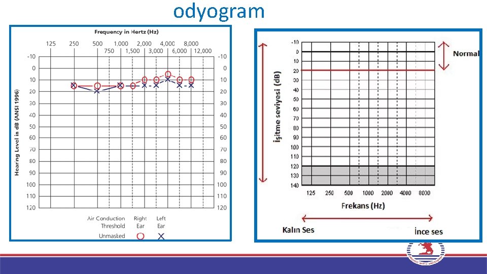 odyogram 