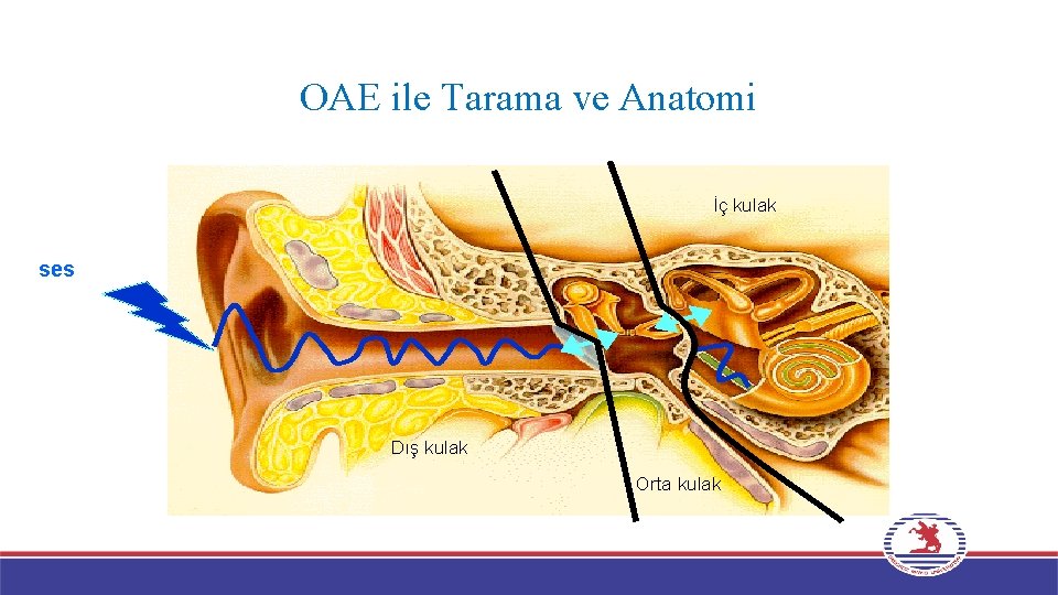 OAE ile Tarama ve Anatomi İç kulak ses Dış kulak Orta kulak 