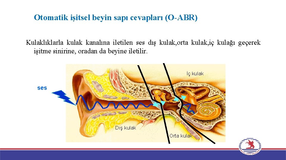 Otomatik işitsel beyin sapı cevapları (O-ABR) Kulaklıklarla kulak kanalına iletilen ses dış kulak, orta