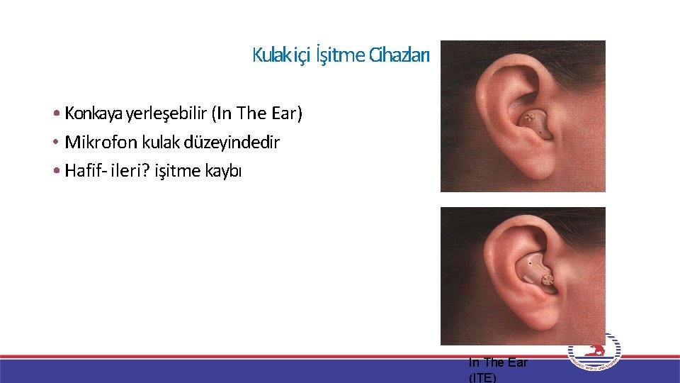 Kulakiçi İşitme Cihazları • Konkaya yerleşebilir (In The Ear) • Mikrofon kulak düzeyindedir •