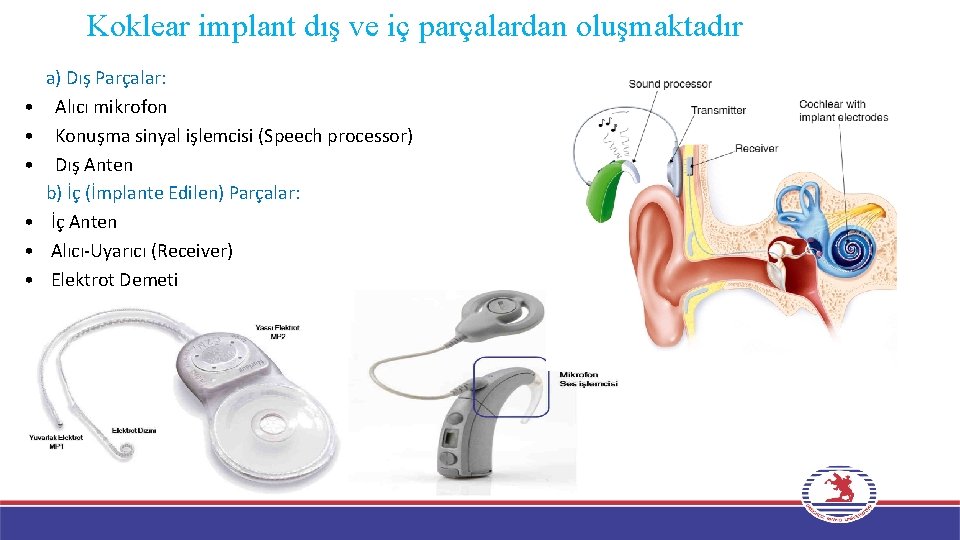 Koklear implant dış ve iç parçalardan oluşmaktadır • • • a) Dış Parçalar: Alıcı