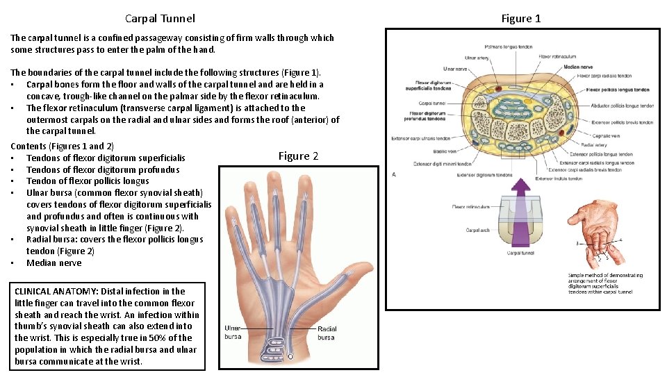 Figure 1 Carpal Tunnel The carpal tunnel is a confined passageway consisting of firm